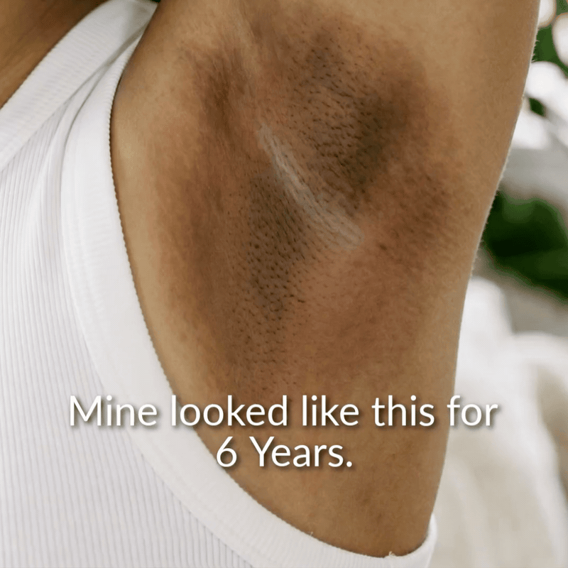 Feature Image